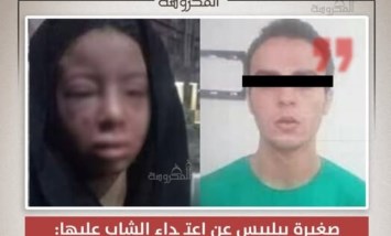 "هقلعلك عينك".. تفاصيل صادمة لواقعة اعتداء في بلبيس