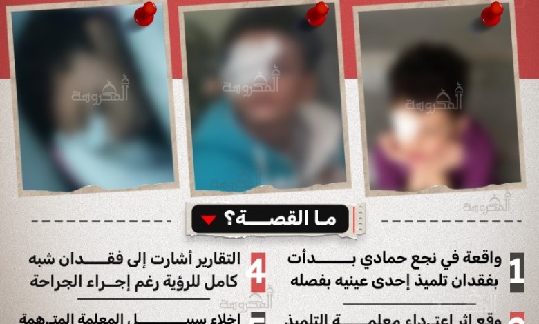 فقد بصره وخرجت بكفالة 2000 جنيه.. القصة الكاملة لواقعة فـقـع عـيـن تلميذ على يد معلمته في قنا