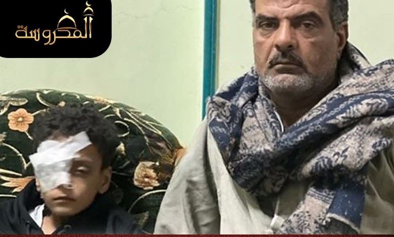 بكفالة 2000 جنيه.. إخلاء سبيل معلمة متهمة بإصابة تلميذ وفقدان عينه في قنا