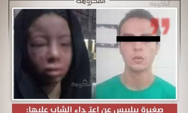 "هقلعلك عينك".. تفاصيل صادمة لواقعة اعتداء في بلبيس