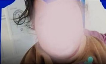 «نزلة شعبية تتحول لكابوس في سوهاج».. عقرب حي داخل ملابس رضيعة يهدد حياتها