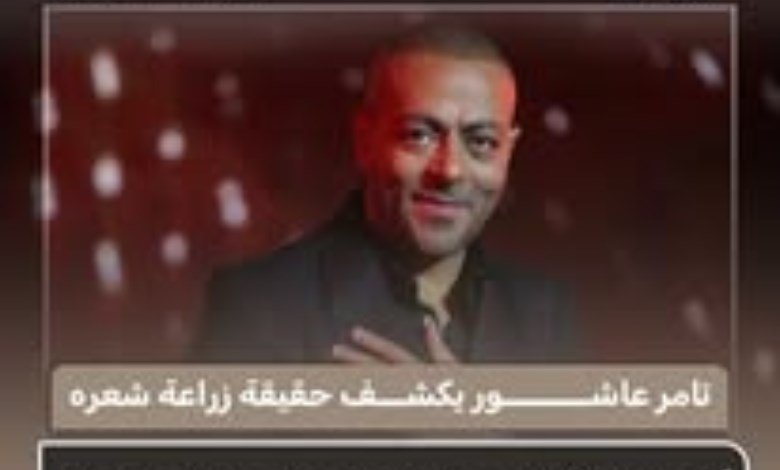 تامر عاشور يكشف حقيقة زراعة شعره: «زرعت وشيلته لأن شكلي كان مش مقبول»