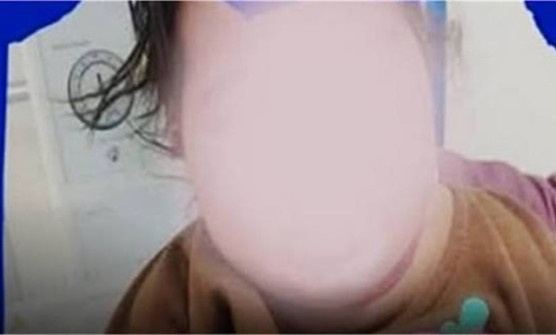 «نزلة شعبية تتحول لكابوس في سوهاج».. عقرب حي داخل ملابس رضيعة يهدد حياتها