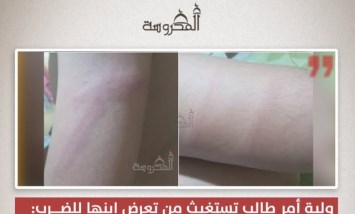 ولية أمر تستغيث: مدرس يعتدي على نجلي داخل المدرسة.. «رجع لي بالمنظر ده»