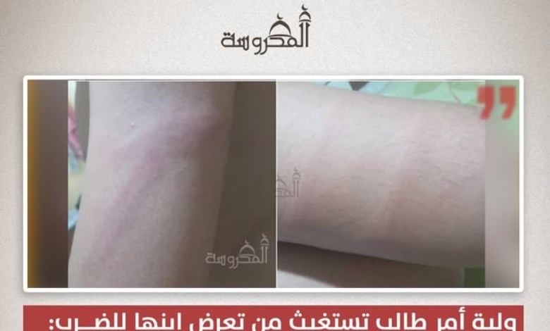 ولية أمر تستغيث: مدرس يعتدي على نجلي داخل المدرسة.. «رجع لي بالمنظر ده»