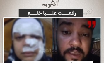 زوج يعتدي على زوجته بعد رفع دعوى خلع.. تفاصيل صادمة في كفر الزيات