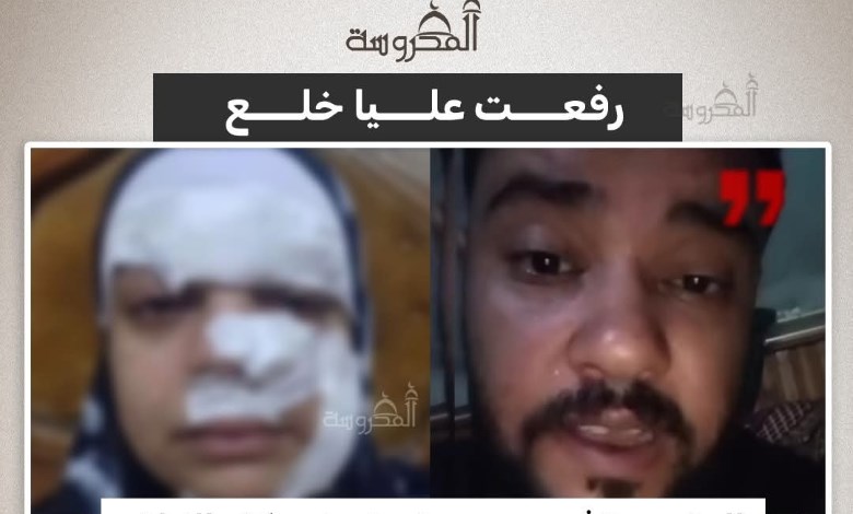 زوج يعتدي على زوجته بعد رفع دعوى خلع.. تفاصيل صادمة في كفر الزيات